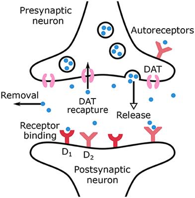 A mechanistic model of ADHD as resulting from dopamine phasic/tonic imbalance during reinforcement learning